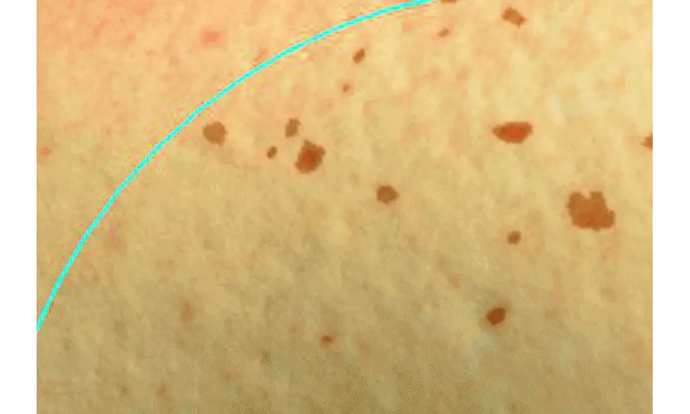 [잡티미백케어] 성분에디터 머루포도 비타 C 잡티크림 50g 상세페이지 4